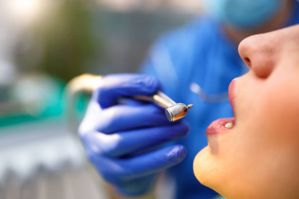 Dental Bonding in Church Point, LA